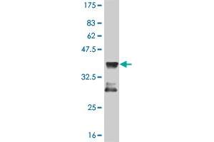 Western Blot detection against Immunogen (36. (MEF2D antibody  (AA 256-351))