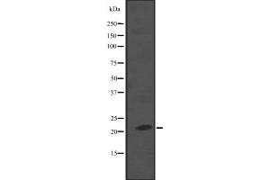 NKIRAS2 antibody  (C-Term)