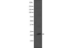 Western blot analysis of NKIRAS2 expression in A549 whole cell lysate ,The lane on the left is treated with the antigen-specific peptide. (NKIRAS2 antibody  (C-Term))