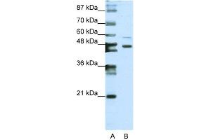 WB Suggested Anti-ZNF558 Antibody Titration:  0. (ZNF558 antibody  (N-Term))