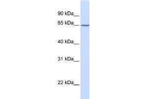 WB Suggested Anti-GALNAC4S-6ST Antibody Titration:  0. (CHST15 antibody  (Middle Region))