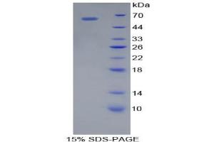 SDS-PAGE analysis of Mouse Cathepsin A Protein. (CTSA Protein)