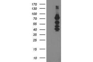 Western Blotting (WB) image for anti-Katanin P80 (WD Repeat Containing) Subunit B 1 (KATNB1) antibody (ABIN1498990)