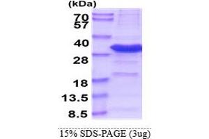 SDS-PAGE (SDS) image for Iodotyrosine Deiodinase (IYD) (AA 24-214) protein (His tag) (ABIN5853588)