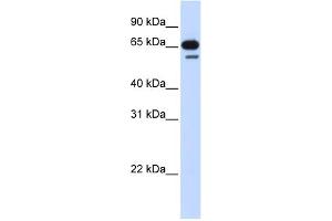 WB Suggested Anti-R3HDM2 Antibody Titration: 0. (R3HDM2 antibody  (Middle Region))