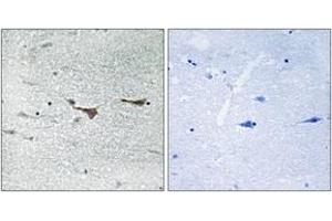 Immunohistochemistry analysis of paraffin-embedded human brain tissue, using TOB1 (Ab-164) Antibody. (Protein Tob1 (TOB1) (AA 130-179) antibody)