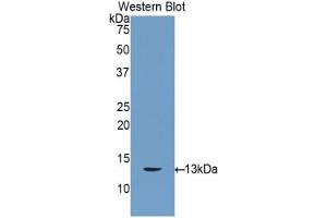 Western blot analysis of the recombinant protein. (Connexin 31 antibody  (AA 7-102))