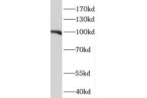 NIH/3T3 cells were subjected to SDS PAGE followed by western blotting (WB) with ABIN7114073 (MEG3 Antibody) at dilution of 1:1000 (MEG3 antibody)