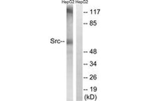 Western blot analysis of extracts from HepG2 cells, using Src (Ab-216) Antibody. (Src antibody  (AA 181-230))