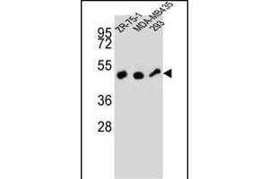 ZFP30 Antibody (N-term) (ABIN657359 and ABIN2846409) western blot analysis in ZR-75-1,MDA-M,293 cell line lysates (35 μg/lane). (ZFP30 antibody  (N-Term))