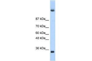WB Suggested Anti-DAZ4 Antibody Titration:  0.