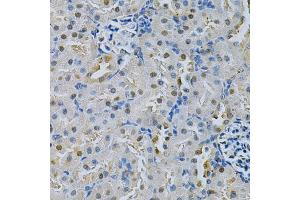 Immunohistochemistry of paraffin-embedded rat kidney using SPHK1 Antibody (ABIN5970017) at dilution of 1/200 (40x lens). (SPHK1 antibody)