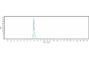 anti-IgE (Talizumab Biosimilar) antibody