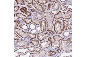 Immunohistochemical staining of human kidney with COX14 polyclonal antibody  shows strong cytoplasmic positivity in cells in tubules.