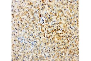 IHC-P: Tec antibody testing of rat liver tissue (NR4A3 antibody  (AA 612-631))