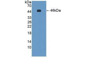Detection of Recombinant PFKM, Rat using Polyclonal Antibody to Phosphofructokinase, Muscle (PFKM) (PFKM antibody  (AA 2-390))