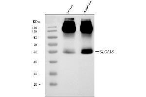 Western blot analysis of EAAT1/SLC1A3 using anti-EAAT1/SLC1A3 antibody (ABIN7602879).