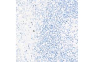 Immunohistochemistry of paraffin-embedded Human tonsil (negative control sample) using TTF1 antibody (ABIN1679475, ABIN3017648, ABIN3017649 and ABIN7101514) at dilution of 1:1000 (40x lens).