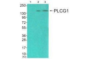 Western blot analysis of extracts from COS7 cells (Lane 2), and JK cells (Lane 3), using PLCG1 (Ab-771) antiobdy. (Phospholipase C gamma 1 antibody  (Tyr771))