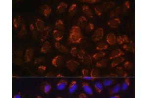 Immunofluorescence analysis of U-2 OS cells using ART1 Polyclonal Antibody at dilution of 1:100. (ART1 antibody)