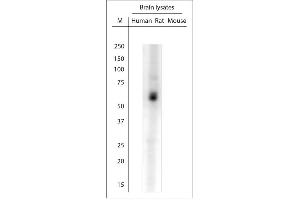 WB on rat spinal cord. (SLC17A8 antibody  (C-Term))