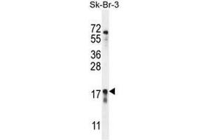 CA115 Antibody (Center) western blot analysis in SK-BR-3 cell line lysates (35µg/lane).