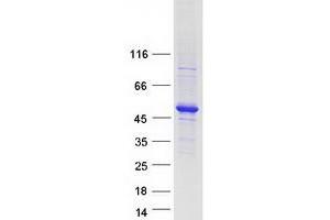 Western Blotting (WB) image for Transcriptional Adaptor 3 (TADA3) (Transcript Variant 2) protein (Myc-DYKDDDDK Tag) (ABIN2733189)