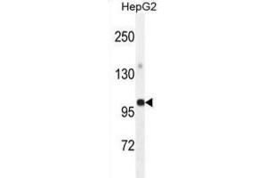 Western Blotting (WB) image for anti-Glycerol-3-Phosphate Acyltransferase, Mitochondrial (GPAM) antibody (ABIN2995540) (GPAM antibody)