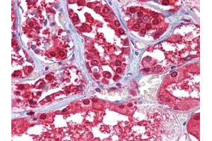 Immunohistochemical analysis of paraffin-embedded human Kidney tissues using GPI mouse mAb.