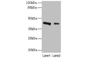 Western blot All lanes: RAD23B antibody at 2 μg/mL Lane 1: 293T whole cell lysate Lane 2: MCF-7 whole cell lysate Secondary Goat polyclonal to rabbit IgG at 1/10000 dilution Predicted band size: 44, 36 kDa Observed band size: 44 kDa