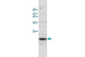 Western blot analysis of BGC-823 whole cell lystae with IL17A polyclonal antibody  at 1:500 dilution. (Interleukin 17a antibody)