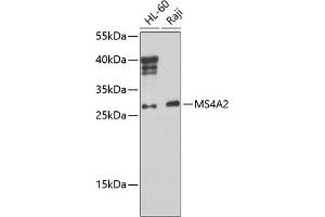 Western blot analysis of extracts of various cell lines, using MS4 Antibody (ABIN6134756, ABIN6144054, ABIN6144055 and ABIN6224638) at 1:1000 dilution. (MS4A2 antibody  (AA 1-100))