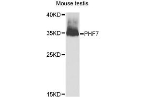 Western blot analysis of extracts of Mouse testis cells, using PHF7 antibody.