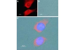Expression of SERCA1 in mouse C2C12 myoblast cell line - Immunocytochemical staining of fixed and permeabilized C2C12 cells. (ATP2A1/SERCA1 antibody  (Cytosolic))