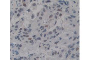 IHC-P analysis of breast tissue, with DAB staining.