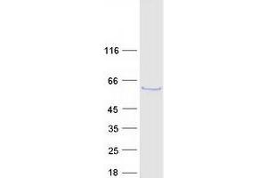 Validation with Western Blot