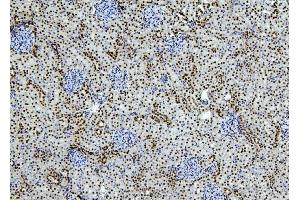 IHC analysis of PTBP1 using anti-PTBP1 antibody (ABIN7599451). (PTBP1 antibody  (AA 1-504))