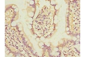Immunohistochemistry of paraffin-embedded human small intestine tissue using ABIN7153881 at dilution of 1:100 (GLP2R antibody  (AA 1-180))