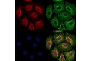 ABIN6262120 and ABIN6273253 staining Hela cells by IF/ICC. (GSTM4 antibody  (Internal Region))