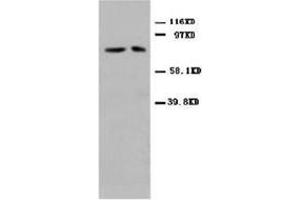 Western blot analysis of rat cardiac muscle tissue lysis using MFN antibody (MFN2 antibody  (N-Term))