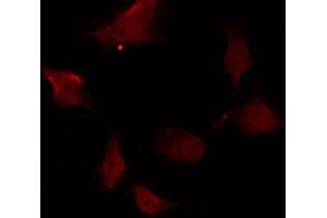 ABIN6267256 staining COS7 by IF/ICC. (ABL1 antibody  (pTyr393, pTyr412))