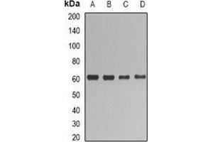 Western blot analysis of UGT1A1 expression in HepG2 (A), SHSY5Y (B), mouse liver (C), rat liver (D) whole cell lysates. (UGT1A1 antibody)