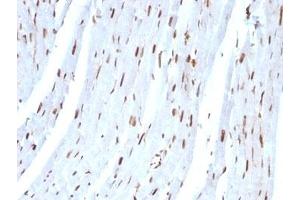 Formalin-fixed, paraffin-embedded rat heart stained with SUMO-2 antibody. (SUMO2 antibody)