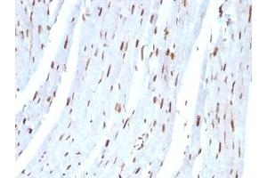 Formalin-fixed, paraffin-embedded rat heart stained with SUMO-2 antibody.