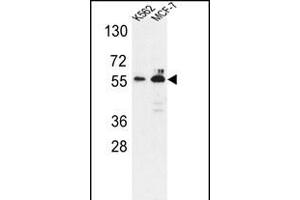 Western blot analysis of G6PD Antibody (Center) (ABIN651286 and ABIN2840171) in K562,MCF-7 cell line lysates (35 μg/lane). (Glucose-6-Phosphate Dehydrogenase antibody  (AA 297-326))