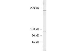 dilution: 1 : 1000, sample: rat hippocampus homogenate (SHANK3 antibody  (AA 1055-1616))