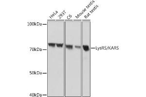 Western blot analysis of extracts of various cell lines, using LysRS/KARS Rabbit mAb (ABIN7268350) at 1:1000 dilution.