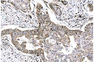 IHC analysis of GRHL2 using anti-GRHL2 antibody (ABIN7599505). (GRHL2 antibody  (AA 1-625))