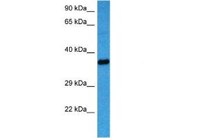 Host:  Mouse  Target Name:  AKR1B1  Sample Tissue:  Mouse Heart  Antibody Dilution:  1ug/ml (AKR1B1 antibody  (C-Term))