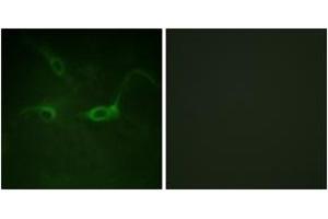 Immunofluorescence analysis of COS7 cells, using FGFR1 (Phospho-Tyr654) Antibody. (FGFR1 antibody  (pTyr654))
